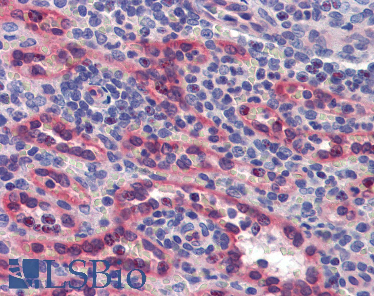 AKIRIN1 Antibody - Anti-AKIRIN1 antibody IHC of human spleen. Immunohistochemistry of formalin-fixed, paraffin-embedded tissue after heat-induced antigen retrieval. Antibody concentration 5 ug/ml.