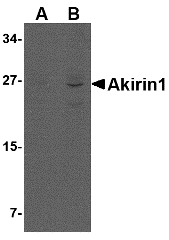 AKIRIN1 Antibody - Western blot of Akirin1 in rat liver lysate with Akirin1 antibody at (A) 1 and (B) 2 ug/ml.
