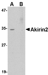 AKIRIN2 Antibody - Western blot of Akirin2 in Human Brain tissue lysate with Akirin2 antibody at 0.5 ug/ml in (A) the absence and (B) the presence of blocking peptide.