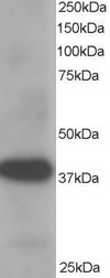 AKR1A1 Antibody - Antibody staining (1 ug/ml) of Human Placenta lysate (RIPA buffer, 35 ug total protein per lane). Primary incubated for 1 hour. Detected by Western blot of chemiluminescence.