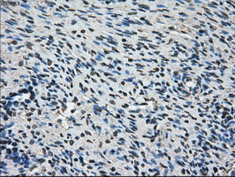 AKR1A1 Antibody - IHC of paraffin-embedded Human Ovary tissue using anti-AKR1A1 mouse monoclonal antibody.