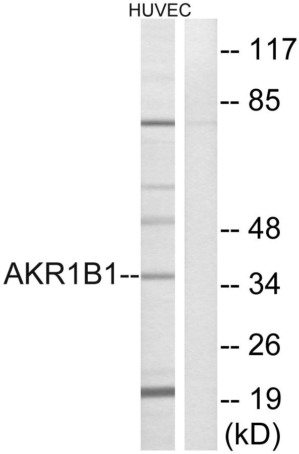 AKR1B1 / Aldose Reductase Antibody - Western blot analysis of lysates from HUVEC cells, using AKR1B1 Antibody. The lane on the right is blocked with the synthesized peptide.