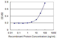 AKR1B1 / Aldose Reductase Antibody - Detection limit for recombinant GST tagged AKR1B1 is 1 ng/ml as a capture antibody.