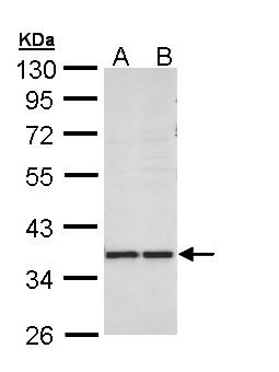 AKR1B10 Antibody - Sample (30 ug of whole cell lysate). A: MOLT4 , B: Raji . 10% SDS PAGE. AKR1B10 antibody diluted at 1:1000