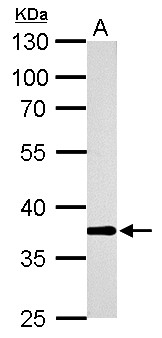 AKR1B10 Antibody - AKR1B10 antibody detects AKR1B10 protein by Western blot analysis. A. 50 ug mouse colon lysate/extract. 10 % SDS-PAGE. AKR1B10 antibody dilution:1:5000