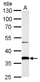 AKR1B10 Antibody - AKR1B10 antibody detects AKR1B10 protein by Western blot analysis. A. 50 ug rat colon lysate/extract. 10 % SDS-PAGE. AKR1B10 antibody dilution:1:5000