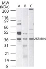 AKR1B10 Antibody - Western blot of AKR1B10 in A) human, B) mouse, and C) rat liver tissue lysate using AKR1B10 Antibody at 1 ug/ml.