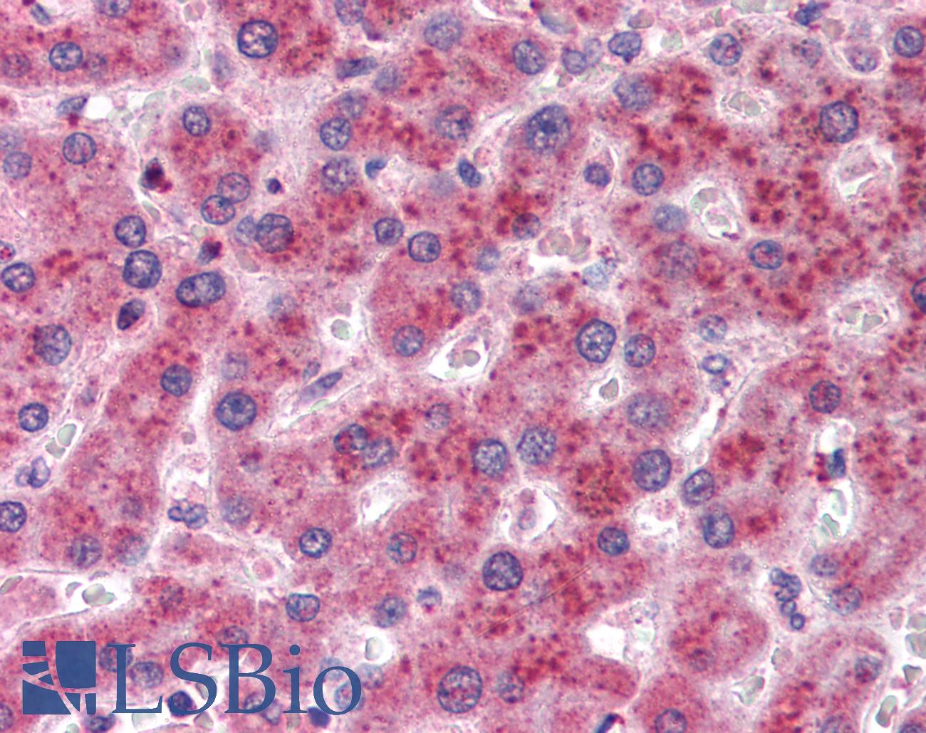 AKR1C4 / Chlordecone Reductase Antibody - Anti-AKR1C4 antibody IHC of human liver. Immunohistochemistry of formalin-fixed, paraffin-embedded tissue after heat-induced antigen retrieval. Antibody concentration 5 ug/ml.