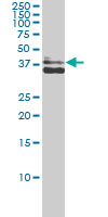 AKR1C4 / Chlordecone Reductase Antibody - AKR1C4 monoclonal antibody (M01), clone 2C11 Western blot of AKR1C4 expression in MCF-7.