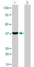 AKR1C4 / Chlordecone Reductase Antibody - Western blot of AKR1C4 expression in transfected 293T cell line by AKR1C4 monoclonal antibody (M01), clone 2C11.