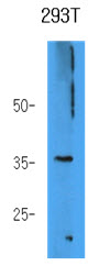 AKR7A3 Antibody - Western Blot: The 293T cell lysate (40 ug) were resolved by SDS-PAGE, transferred to PVDF membrane and probed with anti-human AKR7A3 antibody (1:1000). Proteins were visualized using a goat anti-mouse secondary antibody conjugated to HRP and an ECL detection system.