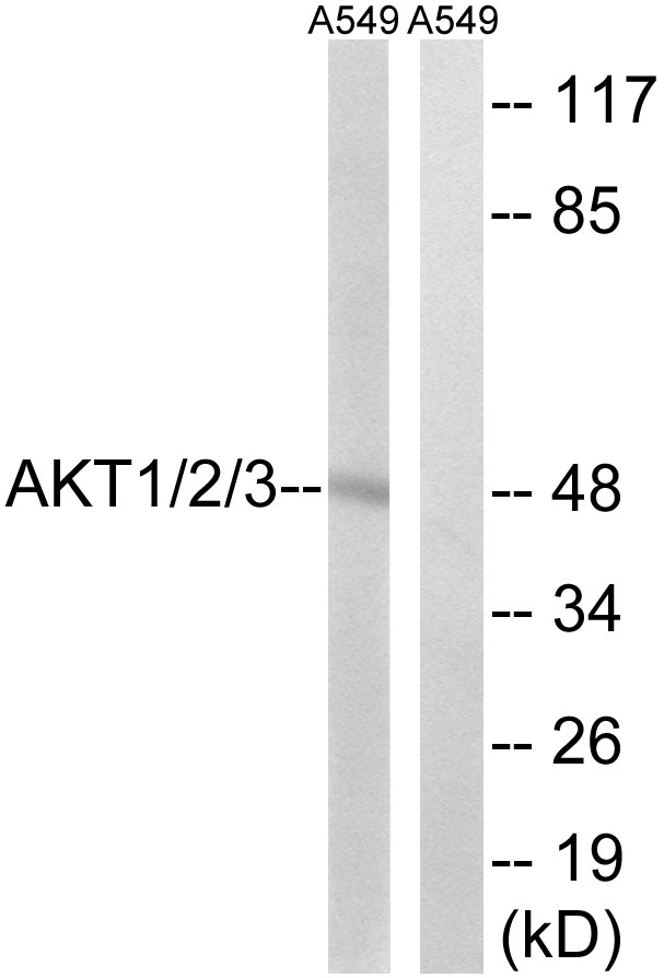 AKT1 + AKT2 + AKT3 Antibody - Western blot analysis of lysates from A549 cells, using AKT1/2/3 Antibody. The lane on the right is blocked with the synthesized peptide.