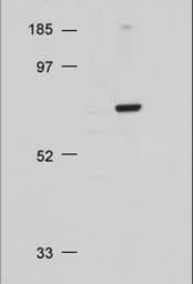AKT1 + AKT2 + AKT3 Antibody - Western Blot. Rabbit anti-AKT was used at a 1:500 dilution to detect AKT by Western blot.