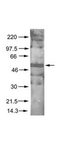 AKT1 + AKT2 + AKT3 Antibody - Anti-AKT pS473 Antibody - Western Blot. Rabbit anti-AKT pS473 was used at a 1:200 dilution to detect phosphorylated AKT by Western blot. A nuclear extract from cells infected with adenovirus expressing nuclear-targeted AKT kinase was used.