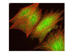 AKT1 + AKT2 + AKT3 Antibody - Anti-AKT pS473 Antibody - Immunofluorescence Microscopy. Confocal image using Rabbit anti-AKT pS473 at a 1:40 dilution to detect phosphorylated AKT (green) by immunofluorescence microscopy in cardiomyocytes infected with adenovirus expressing with wild-type AKT in conjunction with a Texas-red conjugated phalloidin (red) to label filamentous actin.