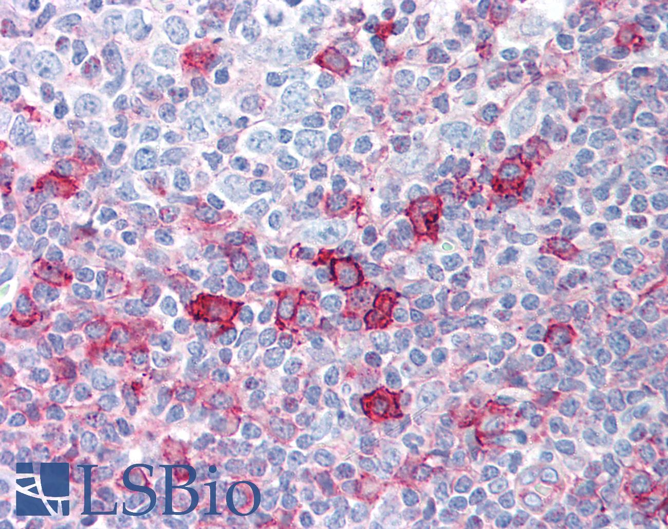 AKT1 + AKT2 + AKT3 Antibody - Anti-AKT1 antibody IHC of human tonsil. Immunohistochemistry of formalin-fixed, paraffin-embedded tissue after heat-induced antigen retrieval. Antibody concentration 5 ug/ml.