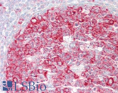 AKT1 Antibody - Human Tonsil: Formalin-Fixed, Paraffin-Embedded (FFPE)