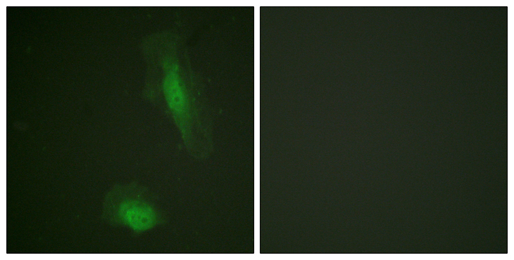 AKT1 Antibody - Immunofluorescence analysis of HeLa cells, using Akt Antibody. The picture on the right is blocked with the synthesized peptide.