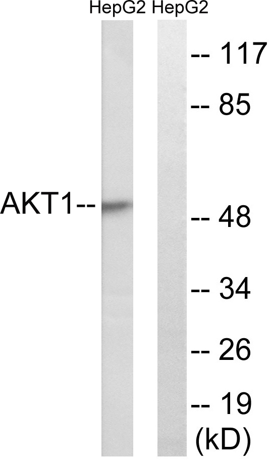 AKT1 Antibody - Western blot analysis of lysates from HepG2 cells, treated with Serum 30% 30', using Akt Antibody. The lane on the right is blocked with the synthesized peptide.