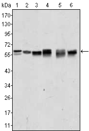 AKT2 Antibody - Western blot using AKT2 mouse monoclonal antibody against A431 (1), Jurkat (2), HEK293 (3), A549 (4), MCF-7 (5) and PC-12 (6) cell lysate.