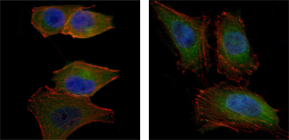 AKT2 Antibody - Immunofluorescence of PANC-1 (left) and HeLa (right) cells using AKT2 mouse monoclonal antibody (green). Blue: DRAQ5 fluorescent DNA dye. Red: Actin filaments have been labeled with Alexa Fluor-555 phalloidin.
