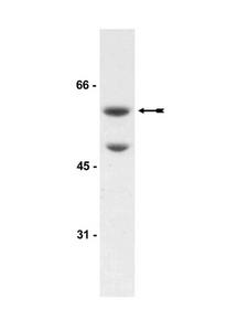 AKT3 Antibody - WB: HEK293 cell lysate was probed with Anti-Akt3 antibody.