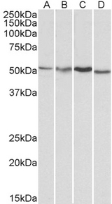 AKT3 Antibody - Goat Anti-AKT3 Antibody (1µg/ml) staining of HepG2 (A), Jurkat (B), Mouse Brain (C) and Rat Brain (D) lysates (35µg protein in RIPA buffer). Primary incubation was 1 hour. Detected by chemiluminescencence.