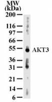 AKT3 Antibody - Western blot analysis for AKT3 using antibody at 2 ug/ml dilution against 30 ug/lane of human kidney lysate .