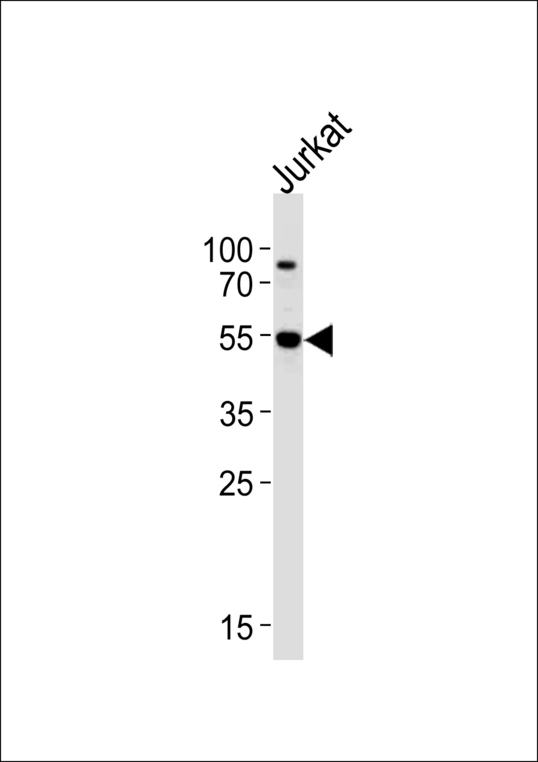 AKT3 Antibody - Western blot of lysate from Jurkat cell line,using AKT3 Antibody (Q103). Antibody was diluted at 1:1000 at each lane. A goat anti-rabbit IgG H&L (HRP) at 1:5000 dilution was used as the secondary antibody.Lysate at 35ug per lane.