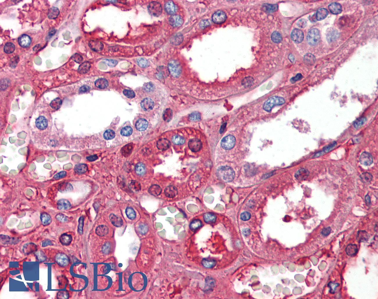ALB / Serum Albumin Antibody - Anti-Serum Albumin antibody IHC of human kidney. Immunohistochemistry of formalin-fixed, paraffin-embedded tissue after heat-induced antigen retrieval. Antibody concentration 5 ug/ml.  This image was taken for the unconjugated form of this product. Other forms have not been tested.