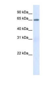 ALB / Serum Albumin Antibody - ALB / Albumin antibody Western blot of 293T cell lysate. This image was taken for the unconjugated form of this product. Other forms have not been tested.