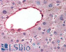 ALB / Serum Albumin Antibody - Anti-Serum Albumin antibody IHC of human liver. Immunohistochemistry of formalin-fixed, paraffin-embedded tissue after heat-induced antigen retrieval. Antibody concentration 5 ug/ml. This image was taken for the unconjugated form of this product. Other forms have not been tested.