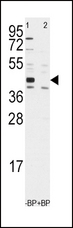 ALDH1A3 Antibody - Western blot of anti-ALDH1A3 Antibody pre-incubated with and without blocking peptide in Jurkat cell line lysate. ALDH1A3 (arrow) was detected using the purified antibody.