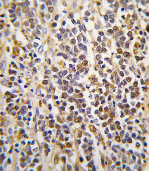 ALDH1A3 Antibody - Formalin-fixed and paraffin-embedded human kidney tissue reacted with ALDH1A3 Antibody , which was peroxidase-conjugated to the secondary antibody, followed by DAB staining. This data demonstrates the use of this antibody for immunohistochemistry; clinical relevance has not been evaluated.
