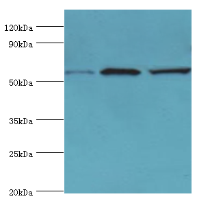 ALDH1B1 Antibody - Western blot. All lanes: Aldehyde dehydrogenase X, mitochondrial antibody at 4 ug/ml. Lane 1: HeLa whole cell lysate. Lane 2: Rat brain tissue. Lane 3: HepG2 whole cell lysate. secondary Goat polyclonal to rabbit at 1:10000 dilution. Predicted band size: 57 kDa. Observed band size: 57 kDa.
