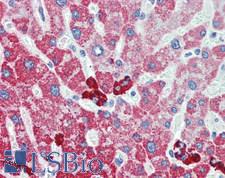 ALDH1B1 Antibody - Human Liver: Formalin-Fixed, Paraffin-Embedded (FFPE), at a concentration of 10 ug/ml.
