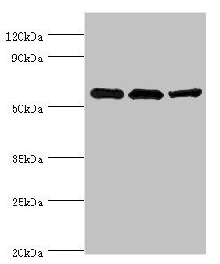 ALDH1B1 Antibody - Western blot All lanes: Aldehyde dehydrogenase X, mitochondrial antibody at 4µg/ml Lane 1: Hela whole cell lysate Lane 2: Rat brain tissue Lane 3: HepG2 whole cell lysate Secondary Goat polyclonal to rabbit IgG at 1/10000 dilution Predicted band size: 57 kDa Observed band size: 57 kDa