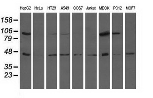ALDH1L1 Antibody - Western blot of extracts (35 ug) from 9 different cell lines by using anti-ALDH1L1 monoclonal antibody.