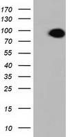 ALDH1L1 Antibody - HEK293T cells were transfected with the pCMV6-ENTRY control (Left lane) or pCMV6-ENTRY ALDH1L1 (Right lane) cDNA for 48 hrs and lysed. Equivalent amounts of cell lysates (5 ug per lane) were separated by SDS-PAGE and immunoblotted with anti-ALDH1L1.