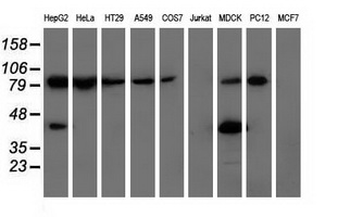 ALDH1L1 Antibody - Western blot of extracts (35 ug) from 9 different cell lines by using anti-ALDH1L1 monoclonal antibody.