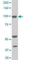 ALDH1L1 Antibody - Western blot of ALDH1L1 expression in NIH/3T3 cells with ALDH1L1 monoclonal antibody, clone 3E9.