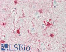 ALDH1L1 Antibody - Human Brain, Cortex: Formalin-Fixed, Paraffin-Embedded (FFPE)