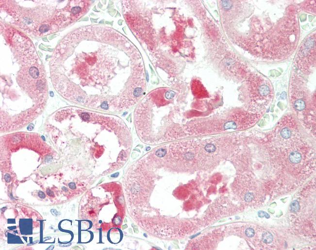 ALDH1L1 Antibody - Anti-ALDH1L1 antibody IHC staining of human kidney. Immunohistochemistry of formalin-fixed, paraffin-embedded tissue after heat-induced antigen retrieval. Antibody concentration 10 ug/ml.