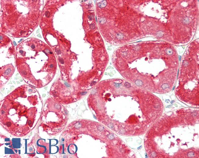 ALDH1L1 Antibody - Anti-ALDH1L1 antibody IHC staining of human kidney. Immunohistochemistry of formalin-fixed, paraffin-embedded tissue after heat-induced antigen retrieval. Antibody concentration 10 ug/ml.