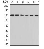 ALDH1L1 Antibody - Western blot analysis of ALDH1L1 expression in MCF7 (A); Jurkat (B); mouse heart (C); mouse kidney (D); rat brain (E); rat liver (F) whole cell lysates.