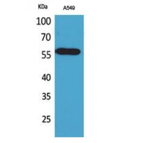 ALDH2 Antibody - Western blot of ALDH2 antibody