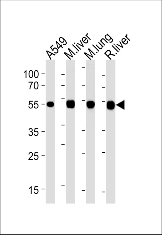 ALDH2 Antibody - ALDH2 Antibody western blot of A549 cell line,mouse liver and lung,rat liver lysates (35 ug/lane). The ALDH2 antibody detected the ALDH2 protein (arrow).