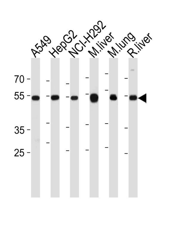 ALDH2 Antibody - ALDH2 Antibody western blot of A549,HepG2,NCI-H292 cell line,mouse liver,lung and rat liver tissue lysates (35 ug/lane). The ALDH2 antibody detected the ALDH2 protein (arrow).