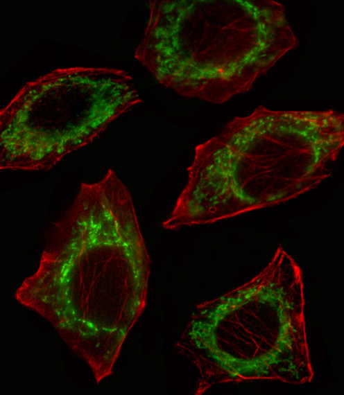 ALDH2 Antibody - Fluorescent confocal image of A549 cell stained with ALDH2 Antibody. A549 cells were fixed with 4% PFA (20 min), permeabilized with Triton X-100 (0.1%, 10 min), then incubated with ALDH2 primary antibody (1:25, 1 h at 37°C). For secondary antibody, Alexa Fluor 488 conjugated donkey anti-rabbit antibody (green) was used (1:400, 50 min at 37°C). Cytoplasmic actin was counterstained with Alexa Fluor 555 (red) conjugated Phalloidin (7units/ml, 1 h at 37°C). Nuclei were counterstained with DAPI (blue) (10 ug/ml, 10 min). ALDH2 immunoreactivity is localized to Mitochondrion significantly.
