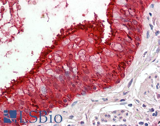 ALDH3A1 Antibody - Anti-ALDH3A1 antibody IHC staining of human lung, respiratory epithelium. Immunohistochemistry of formalin-fixed, paraffin-embedded tissue after heat-induced antigen retrieval.